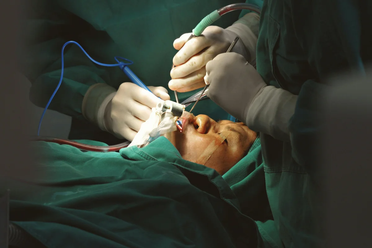 Phaco Cataract Surgery Patiala